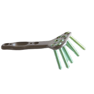 پلاک دیستال رادیوس ولار استوفیکس شرکت مادزیست فن آور بین الملل